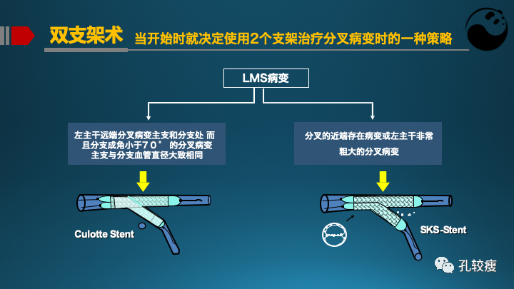 为什么说左主干是一个特殊的分叉