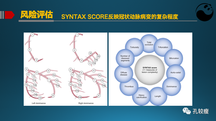 为什么说左主干是一个特殊的分叉