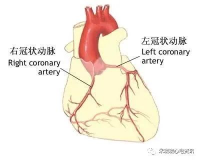 心梗时快速判断梗死部位和范围！