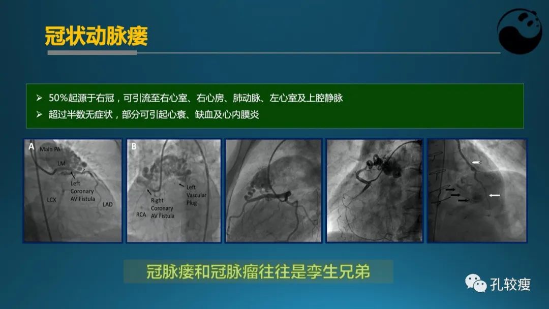从零开始,掌握冠脉造影读片要领