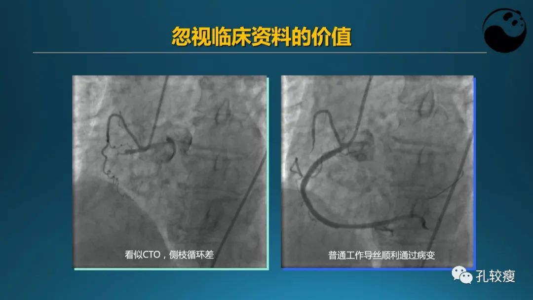 从零开始,掌握冠脉造影读片要领