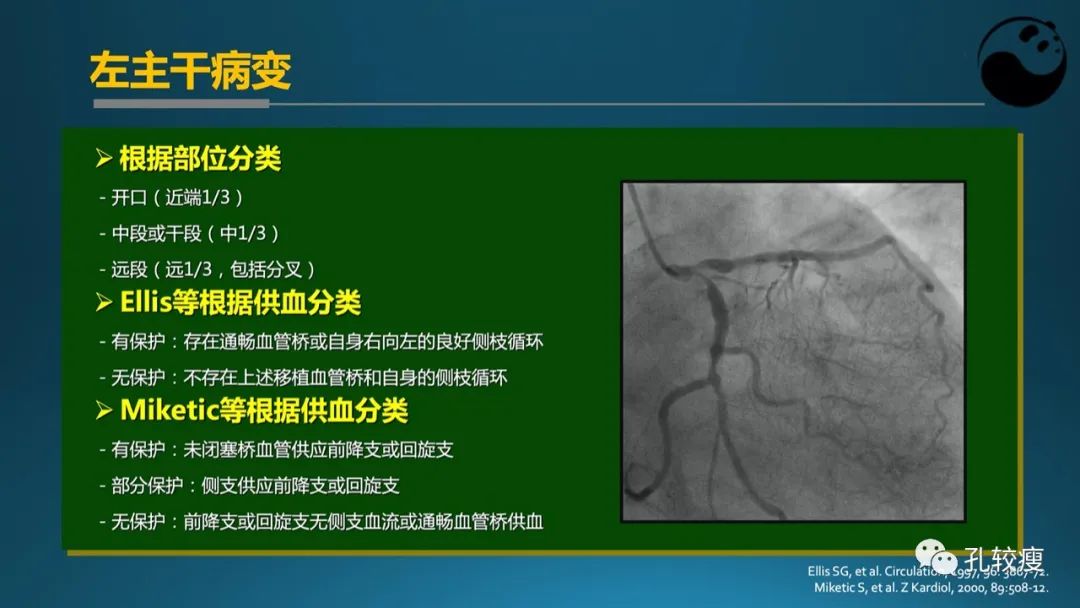 从零开始,掌握冠脉造影读片要领