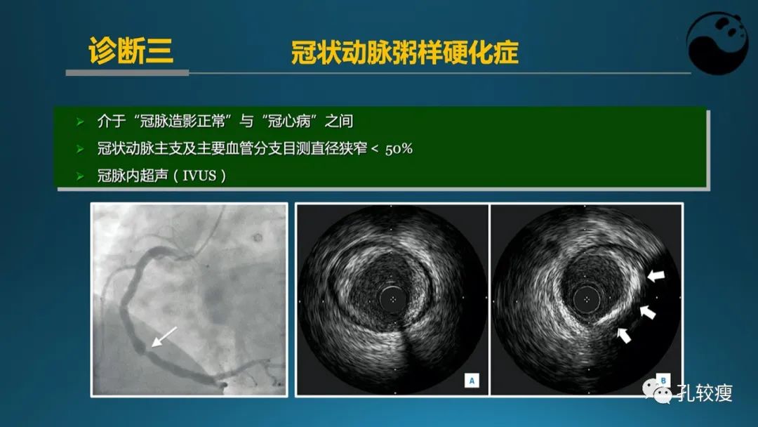 从零开始,掌握冠脉造影读片要领