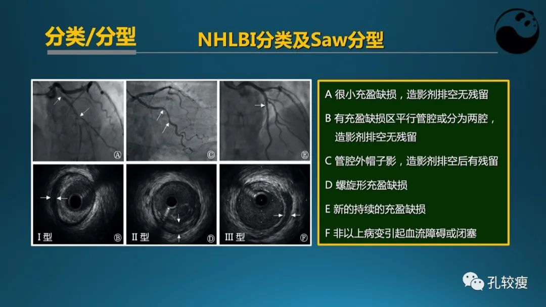 从零开始,掌握冠脉造影读片要领