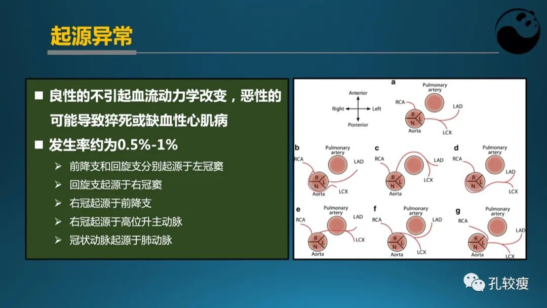 从零开始,掌握冠脉造影读片要领