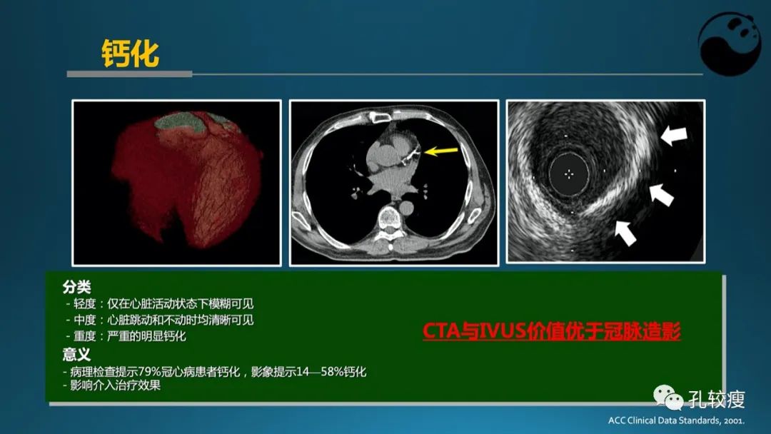 从零开始,掌握冠脉造影读片要领