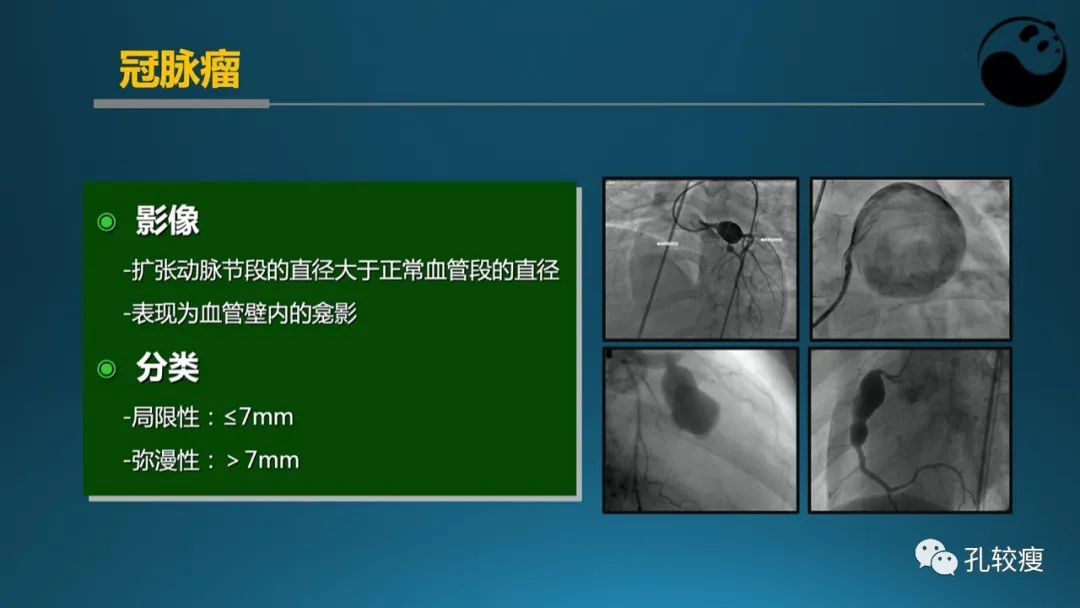 从零开始,掌握冠脉造影读片要领