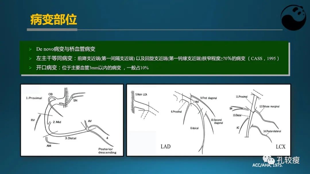 从零开始,掌握冠脉造影读片要领