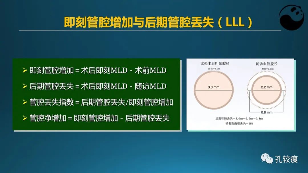 从零开始,掌握冠脉造影读片要领