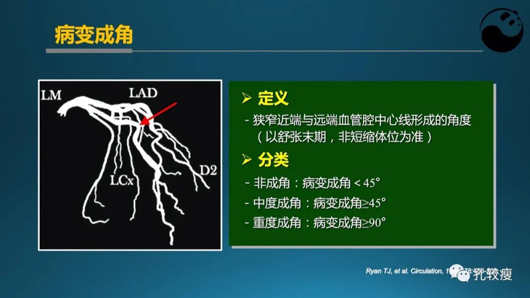 从零开始,掌握冠脉造影读片要领