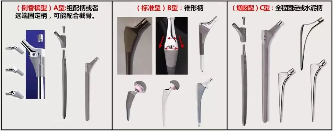 做好初次髋关节置换,这些技巧你掌握了吗?