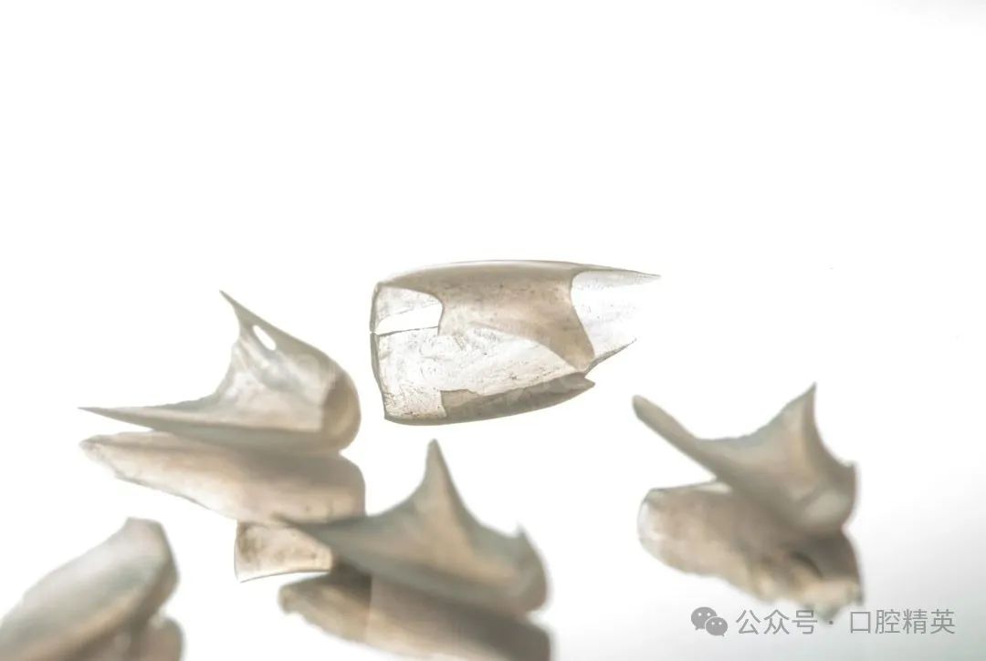 下前牙关闭间隙;不备牙瓷贴面修复