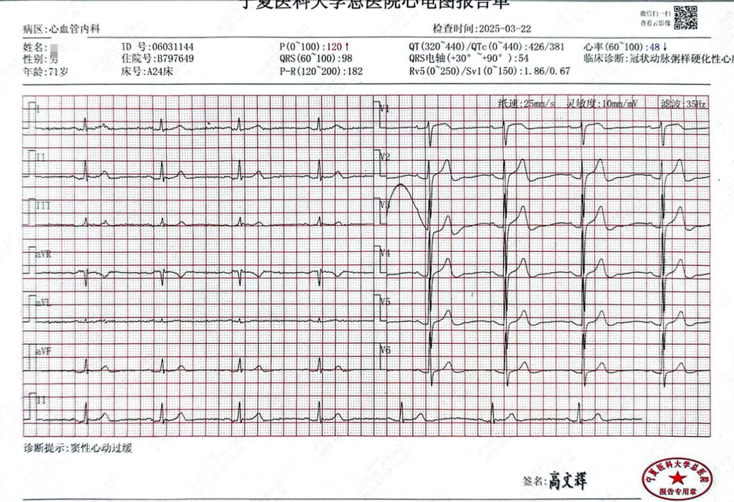 Launcher病例荟 | SAL.75/1.0应用于右冠钙化病变