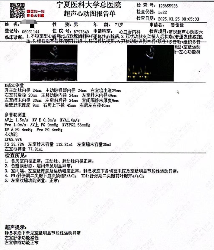 Launcher病例荟 | SAL.75/1.0应用于右冠钙化病变
