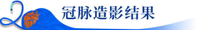 Launcher病例荟 | JR应用于右冠近段病变