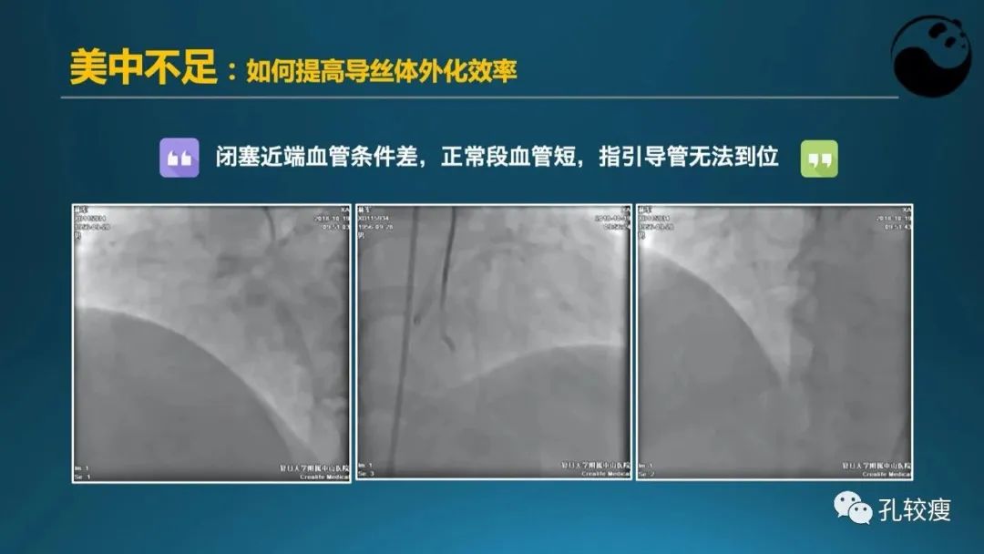 CTO病变主动迎客技术之我见