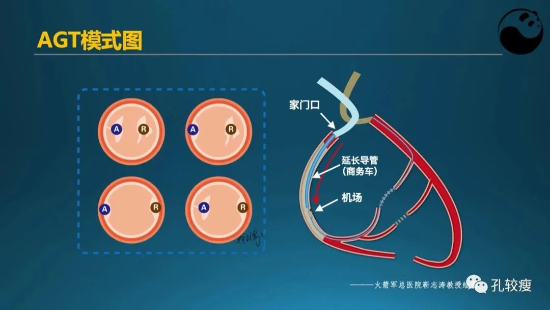 CTO病变主动迎客技术之我见
