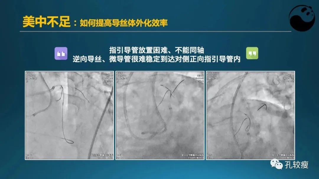 CTO病变主动迎客技术之我见