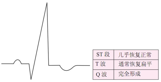 急性心肌梗死（STEMI）心电图（ECG）演变