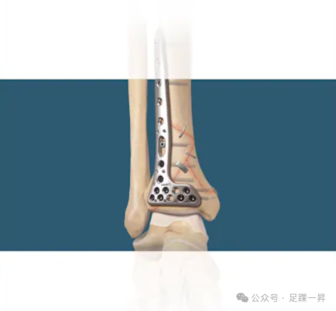 手术技巧