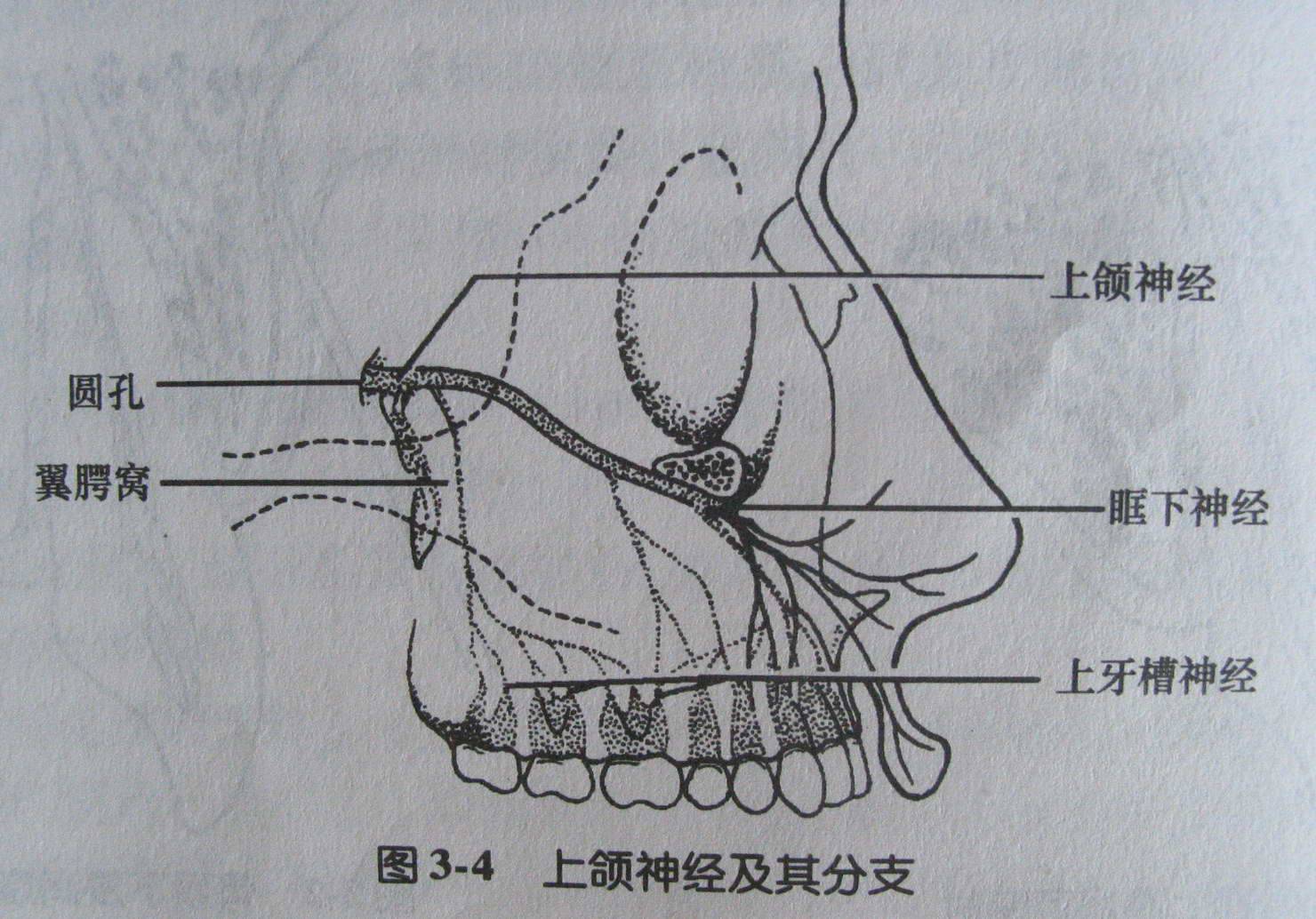 麻醉术：口腔局部麻醉