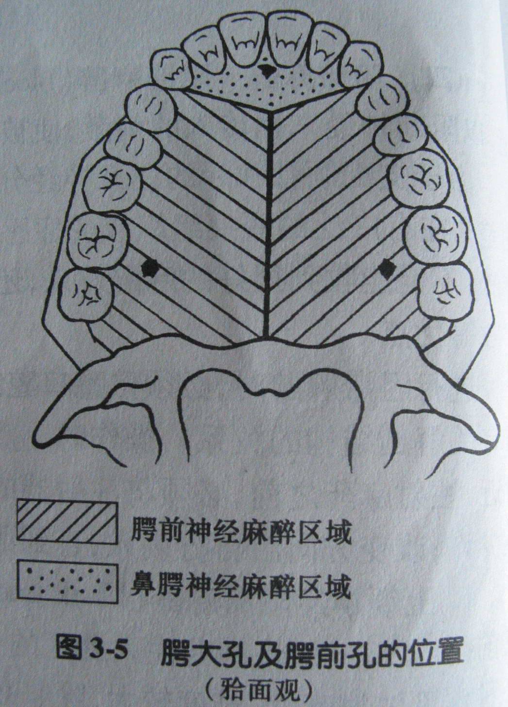 麻醉术：口腔局部麻醉