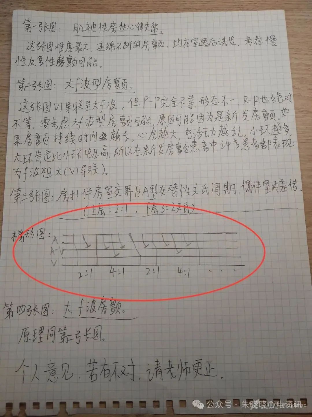 房颤诊断，这些心电图陷阱你踩过吗？