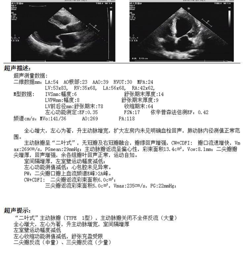 重症心衰诊治典范：一例患者的成功救治之路及经验启示