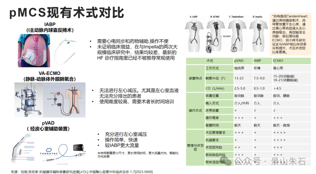 学习笔记：心衰介入治疗