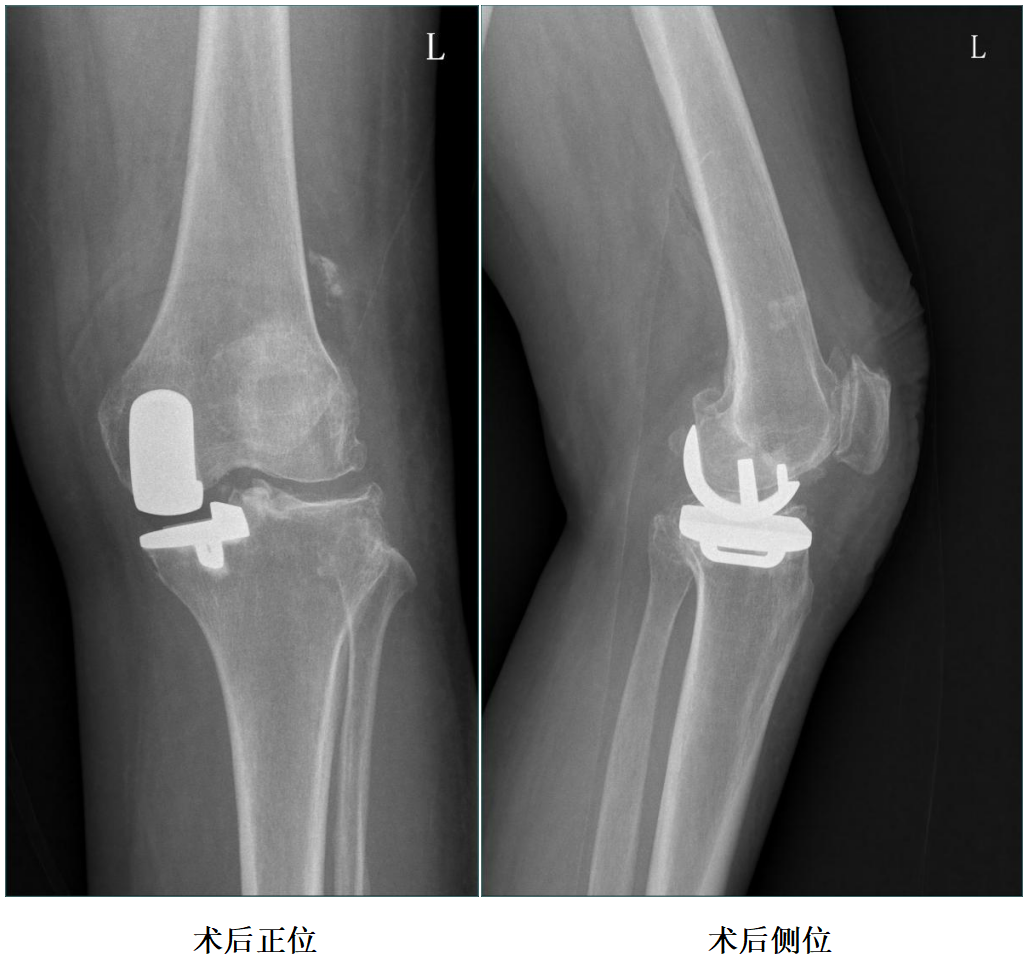 手术视频