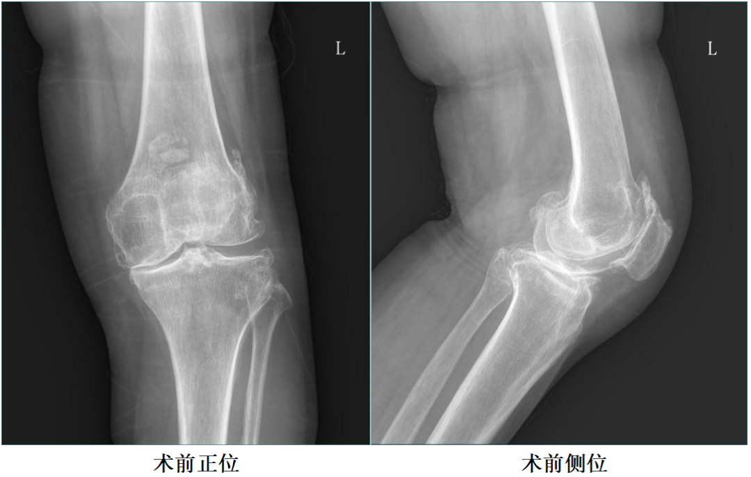手术视频