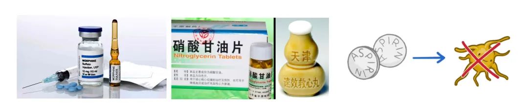 急性冠状动脉综合征,临床必备!