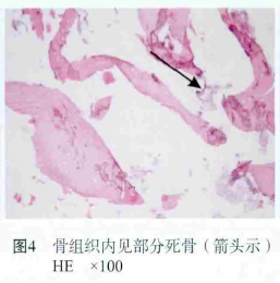 忽视这个“冷门”拔牙禁忌症，风险不容小视！