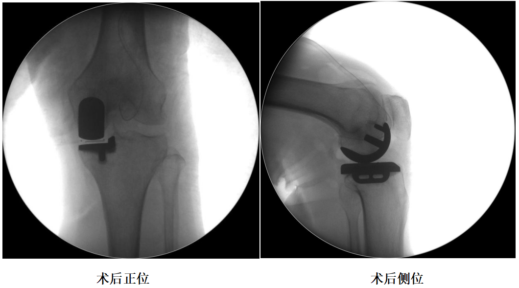 手术视频