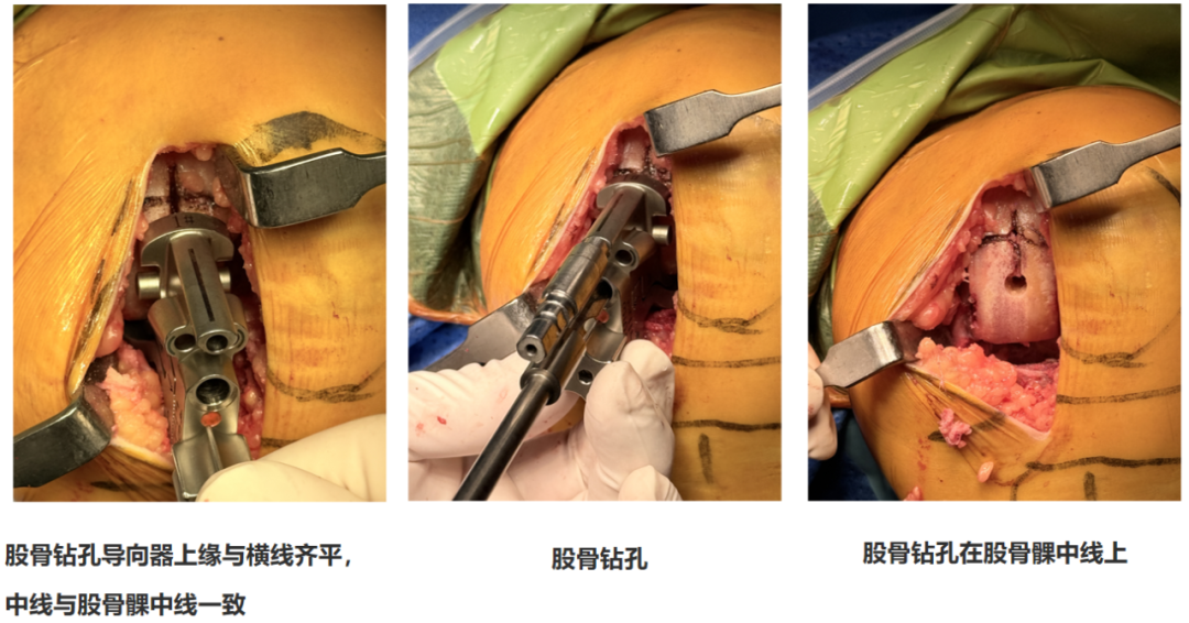 手术视频