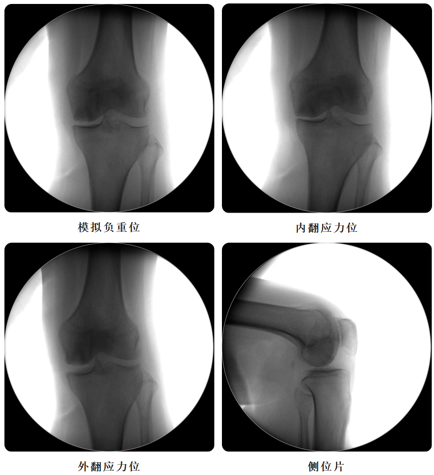 手术视频