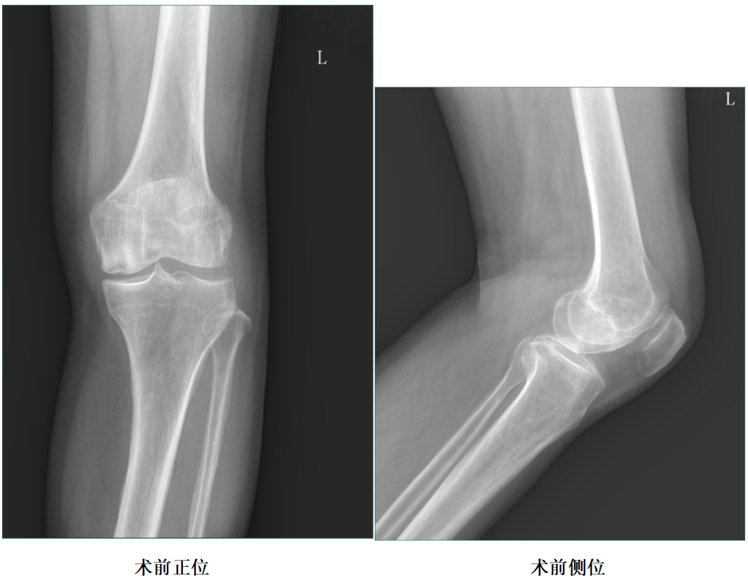 手术视频