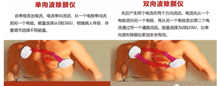 【急救】除颤仪该如何正确使用