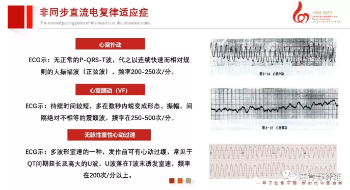 【急救】除颤仪该如何正确使用