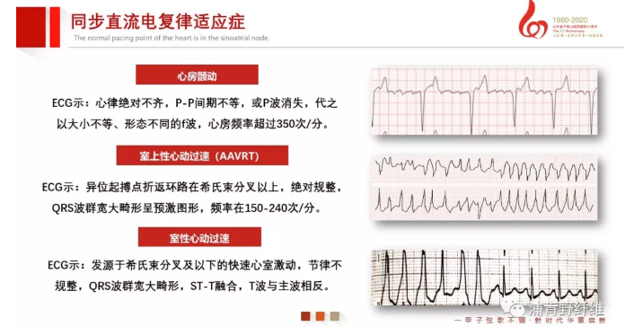 【急救】除颤仪该如何正确使用