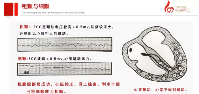 【急救】除颤仪该如何正确使用