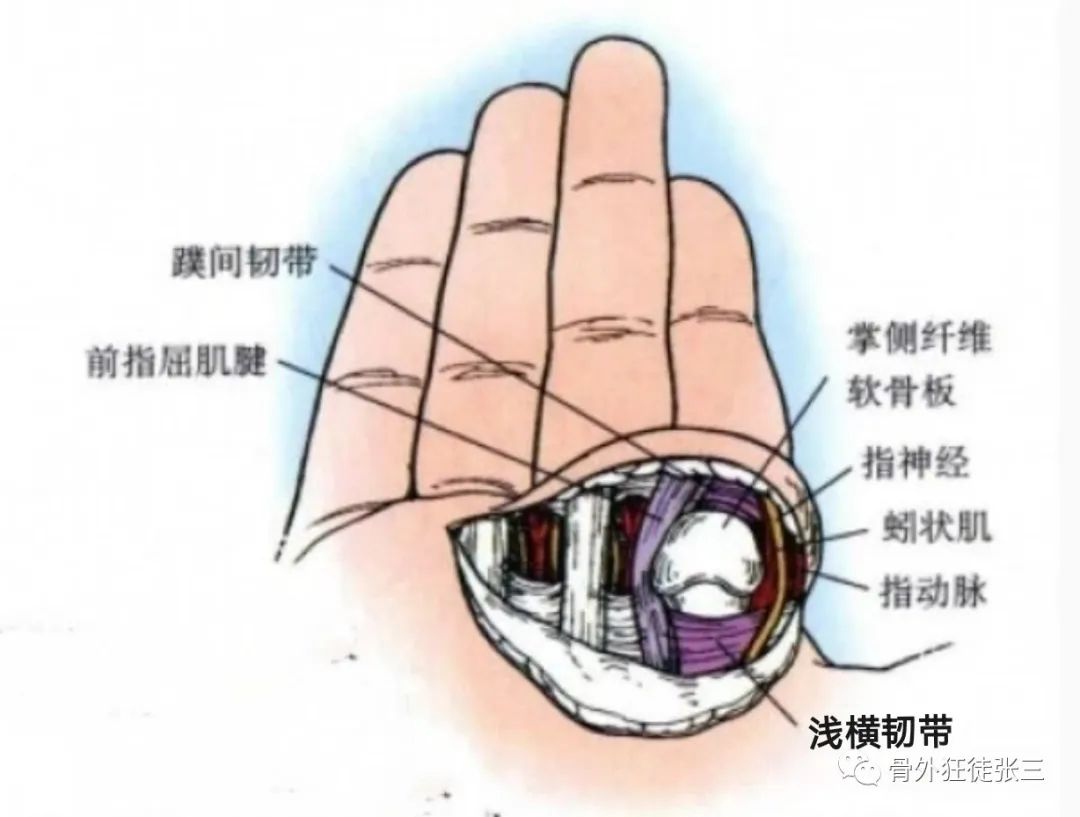 罕见病:掌指关节绞索