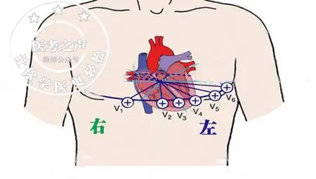 学习心电图,这是我见过最完美的文章!