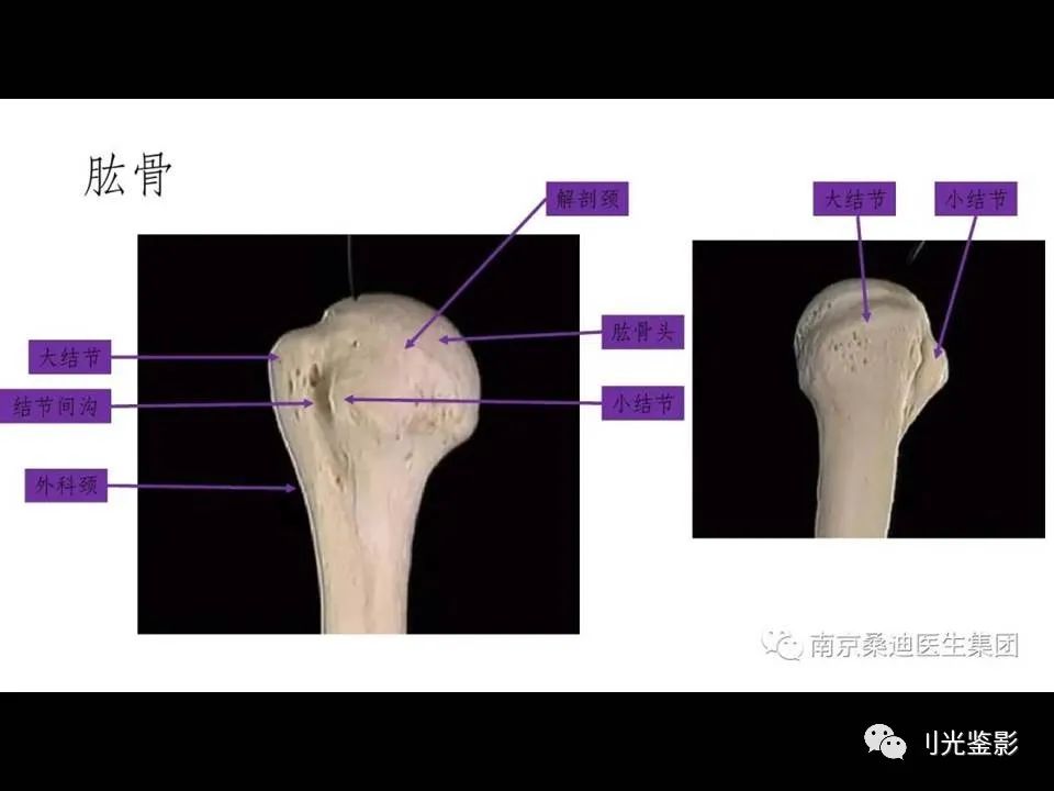 肩关节MRI解剖肩袖损伤诊断技巧--对应动图,效果超赞