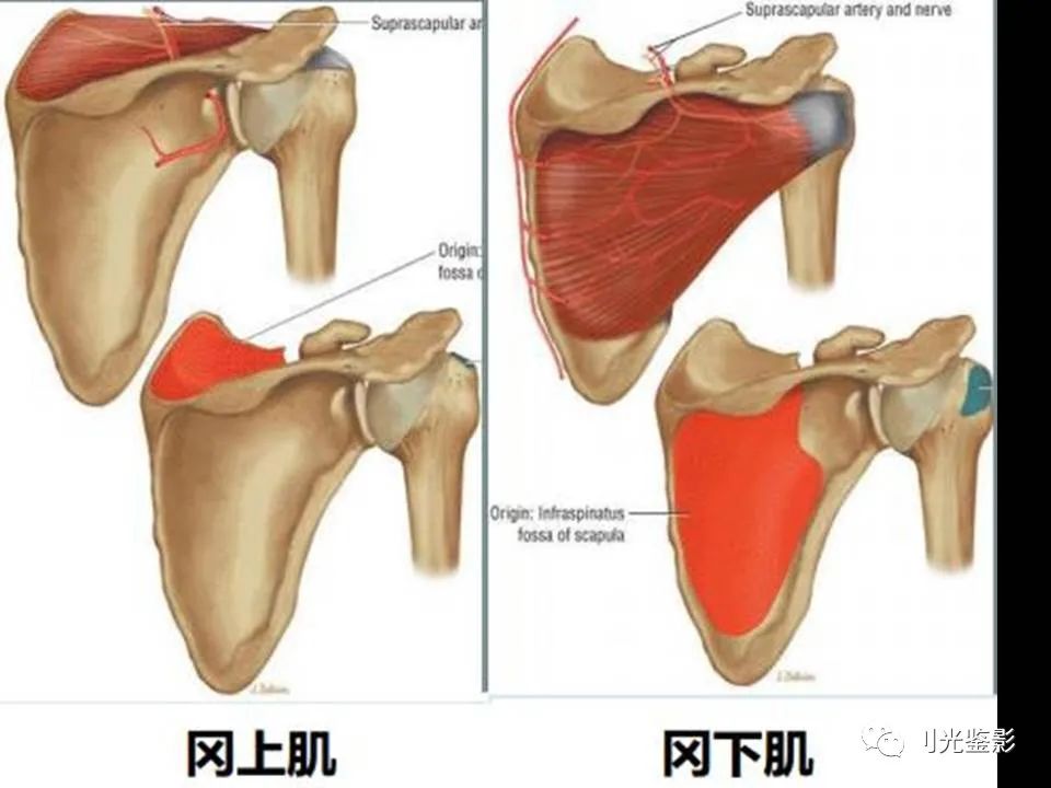 肩关节MRI解剖肩袖损伤诊断技巧--对应动图,效果超赞
