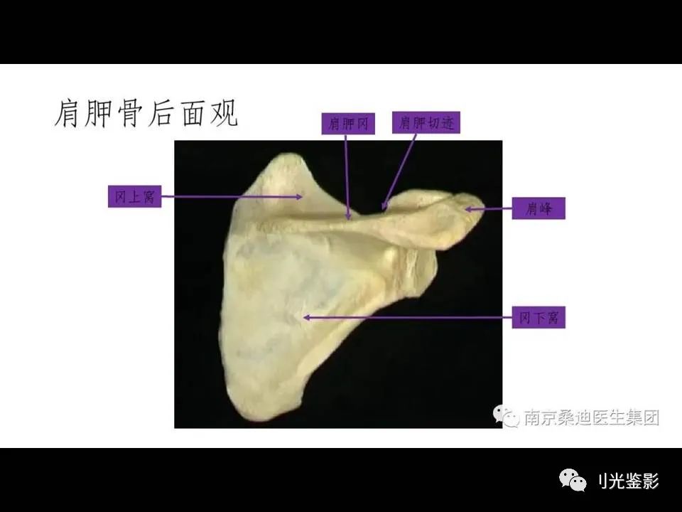 肩关节MRI解剖肩袖损伤诊断技巧--对应动图,效果超赞