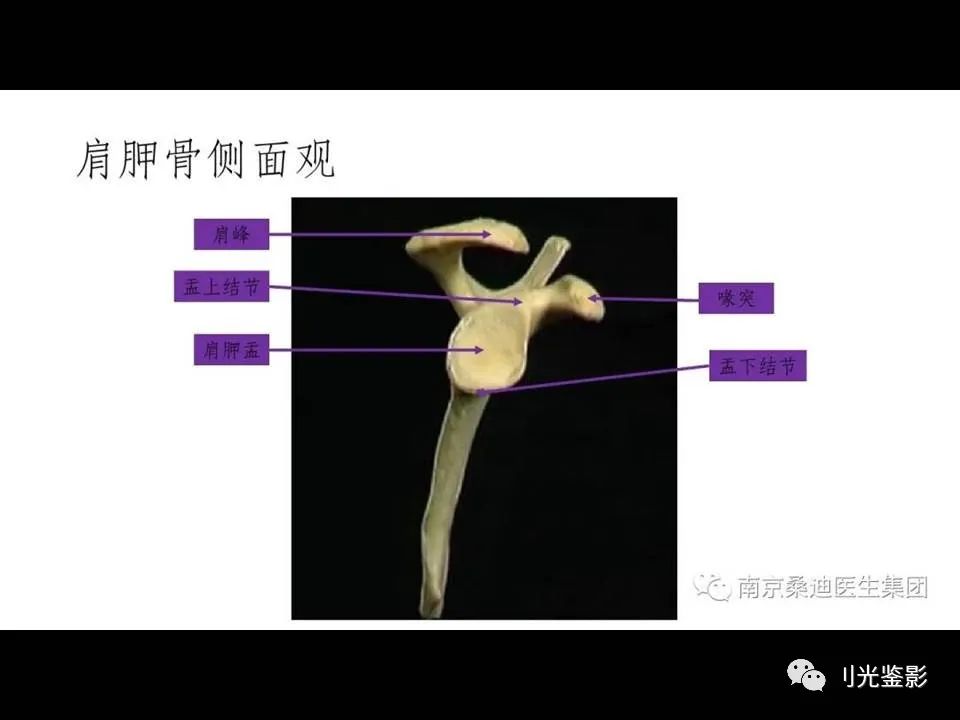肩关节MRI解剖肩袖损伤诊断技巧--对应动图,效果超赞
