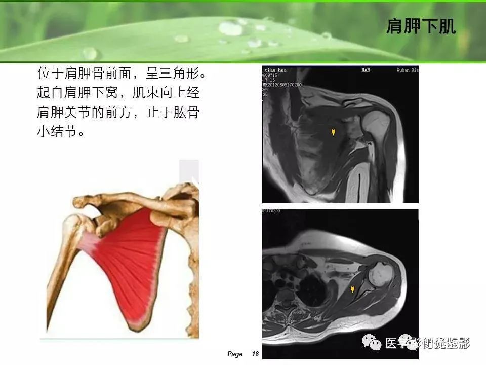 肩关节MRI解剖肩袖损伤诊断技巧--对应动图,效果超赞