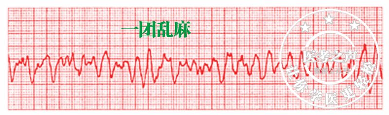 关于心肺复苏发展及心肺复苏核心内容知识点
