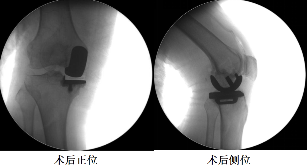 手术视频